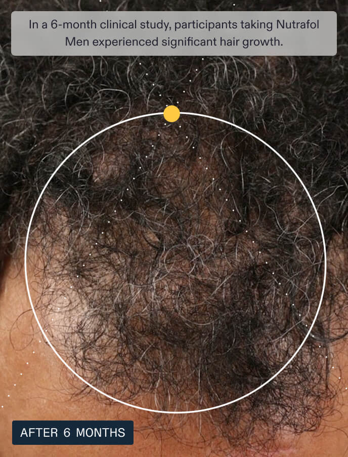 Nutrafol Men's Hair Growth Supplements, Clinically Tested for Visibly Thicker Hair and Scalp Coverage, Dermatologist Recommended